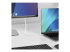 CDP2DP2MBW - StarTech 6.6ft (2m) USB C to DisplayPort 1.2 Cable, Bidirectional - Close up